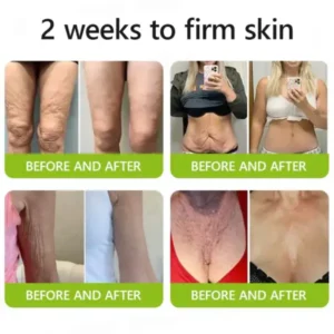 Botox & Retinol Shot - Image 13
