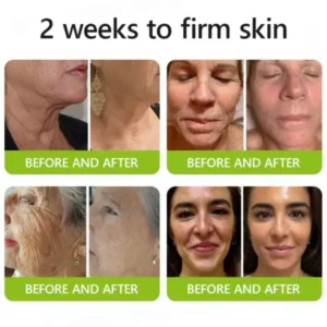 Botox & Retinol Shot - Image 15