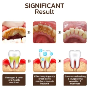 Niacinamide Whitening Toothpaste - Image 7