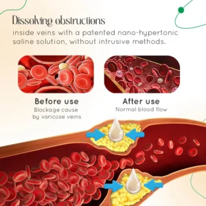 Vein Therapy Cream - Image 4