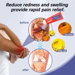 Official Store | Turmeric & Emu Oil Arthritis Soothing Pain Relief Massage Gel - Image 11