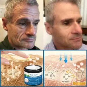 ✅Official Store: Magnesium Skin Repair Cream (Smooths Wrinkles, Firms Skin and Fades Stretch Marks) - Image 5