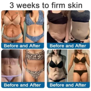 ✅Official Store: Magnesium Skin Repair Cream (Smooths Wrinkles, Firms Skin and Fades Stretch Marks) - Image 8