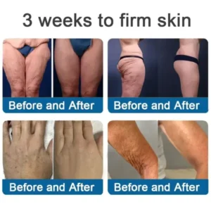 ✅Official Store: Magnesium Skin Repair Cream (Smooths Wrinkles, Firms Skin and Fades Stretch Marks) - Image 9