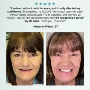 Custom-Fit Functional Dentures - Image 6
