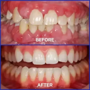 VioGloss Bienengift-Zahntherapie Oral Power 🦷 (🇩🇪 BZÄK Zugelassen) - Image 6