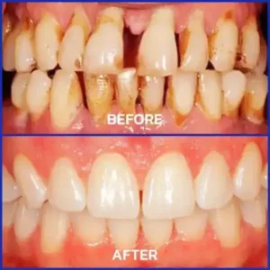 VioGloss Bienengift-Zahntherapie Oral Power 🦷 (🇩🇪 BZÄK Zugelassen) - Image 7