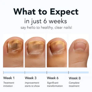 – Nail Repair Patches - Image 5