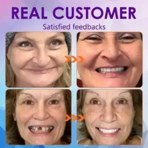 😁 “Snap In. Stay Put. Smile All Day — Or Your Money Back!” 𝗙𝘂𝗻𝗰𝘁𝗶𝗼𝗻𝗮𝗹 𝗧𝗵𝗶𝗰𝗸𝗲𝗻𝗲𝗱 𝗗𝗲𝗻𝘁𝘂𝗿𝗲𝘀 - Image 6