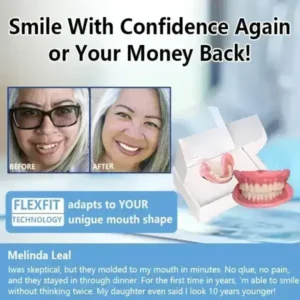 😁 “Snap In. Stay Put. Smile All Day — Or Your Money Back!” 𝗙𝘂𝗻𝗰𝘁𝗶𝗼𝗻𝗮𝗹 𝗧𝗵𝗶𝗰𝗸𝗲𝗻𝗲𝗱 𝗗𝗲𝗻𝘁𝘂𝗿𝗲𝘀 - Image 8