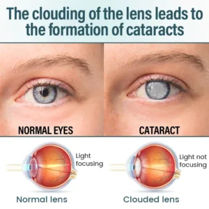 OptiFusion Nano Eye Drops Serum - Image 6