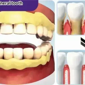 Teeth Restoration Mineral Powder - Image 17