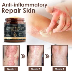 Tallow Bee Venom Skin Restoration Cream - Image 4