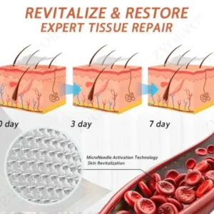 Vein Ease Microneedle Care Patch(For Spider Veins, Varicose Veins, Swelling & Leg Fatigue) - Image 11