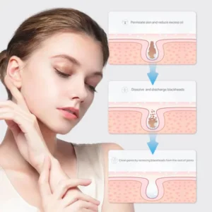 Blackhead Removal Nose Mask - Image 2