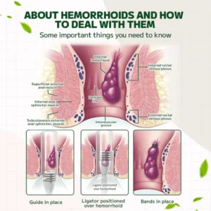 Maximum Strength Hemorrhoids and Fissure Ointment - Image 5