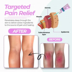 Varicose Veins Cream - Image 8