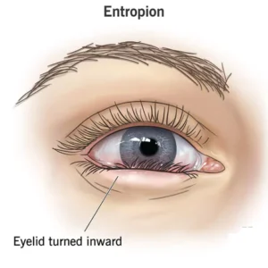 OPENEYES Awaken Peptide Lifting Eye Gel - Image 7