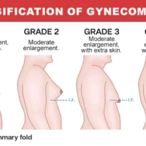 Gynecomastia Cream – Chest Fat Burner - Image 7
