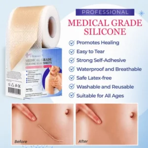 Grade Silicone Scar Sheets - Image 7