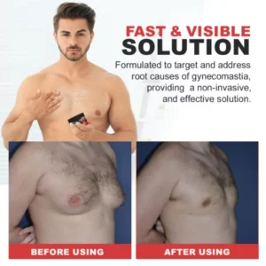 Gynecomastia Cream – Chest Fat Burner - Image 4