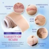 Grade Silicone Scar Sheets