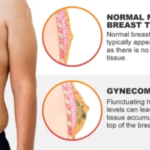 Gynecomastia Cream – Chest Fat Burner - Image 3