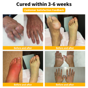 Bee Venom Advanced Joint and Bone Therapy Cream - Image 7