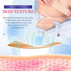 Grade Silicone Scar Sheets - Image 3
