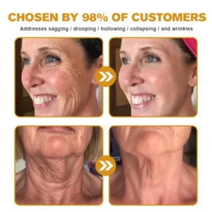 Botox Bee Venom Wrinkle Removal Cream - Image 4