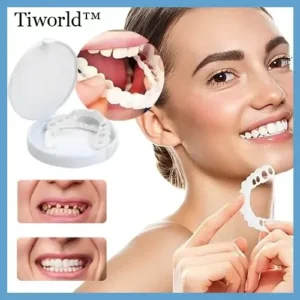 Adjustable Snap-On Dentures - Image 5