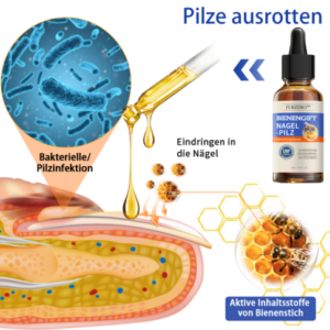 Bee Venom Nail Fungus Treatment Solution - Image 3