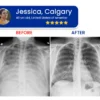 Tri-NanoTargetCOPD Relief Patch