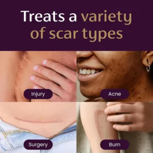 Advanced Scar Gel - Image 7