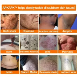 Effective All-in-One Skin Treatment Cream - Image 7