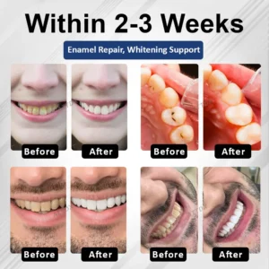 BioEnamel Biomimetic Tooth Armor Drops - Image 2