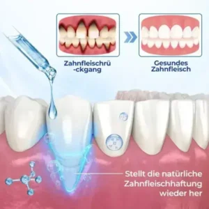 BeeTakt ZahnfleischRepair Lösung - Image 11