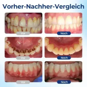 BeeTakt ZahnfleischRepair Lösung - Image 7