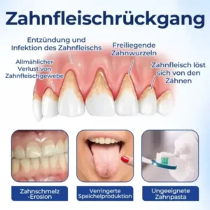 BeeTakt Zahnfleisch-Repair Lösung - Image 7
