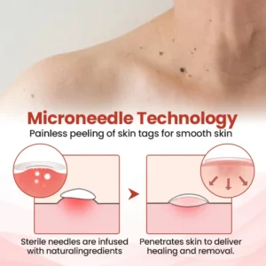 TagDrop Painless Micro Patch - Image 4