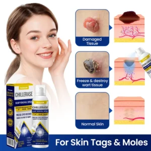 Harisonth ChillErase Bump Renewal Spray - Image 7
