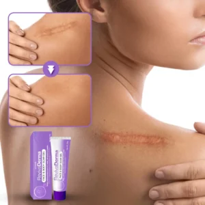 RevivaDerma Face & Body Scar Gel - Image 11