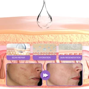 RevivaDerma Face & Body Scar Gel - Image 14