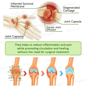 Magnesium & Peppermint Arthritis Pain Relief and Bone Healing Cream - Image 10