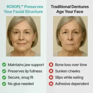 Custom-Fit Functional Dentures - Image 5