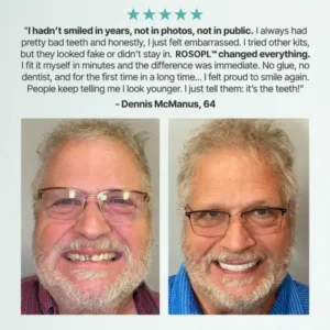 Custom-Fit Functional Dentures - Image 7