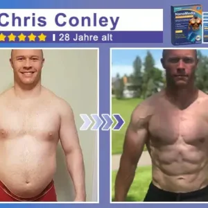 Gynecomastia Breast Fat Burning & Firming Patch - Image 5