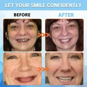 AI Bionic Adsorption Dentures - Image 8