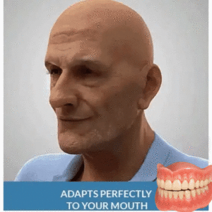 –Advanced Custom-Fit Functional Dentures - Image 8