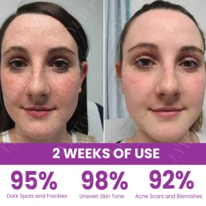 MelantraX Advanced Brightening Essence - Image 8